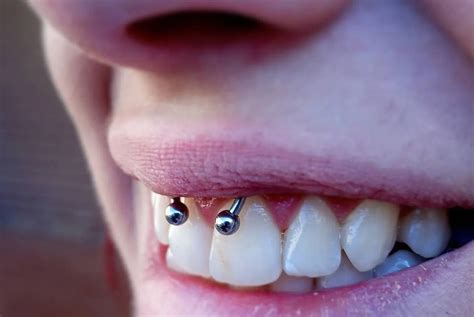 how long does the smiley piercing take to heal|Smiley Piercing: Pain, Risks, Jewelry, Healing,